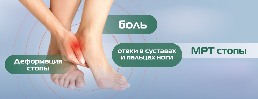 МРТ_нижние конечности, стопа(БЕЗ ЦЕНЫ) (1).png